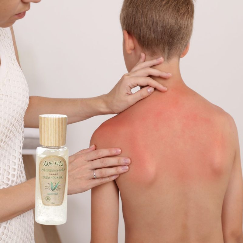 Gel de Aloe Vera Puro (100ml) - Imagen 3